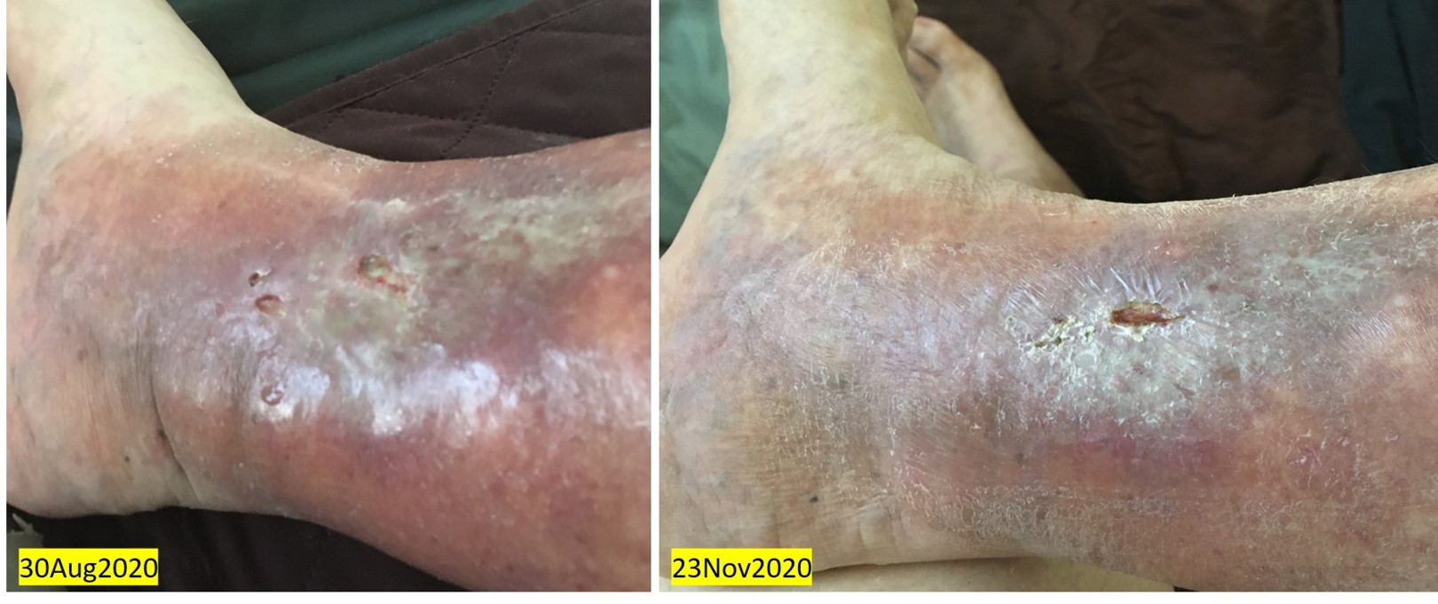 3 months WG Exctract 3 months WG Exctract