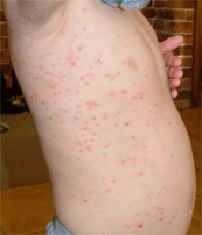 pre_wg3 Before application of wheatgrass Skin Recovery Spray