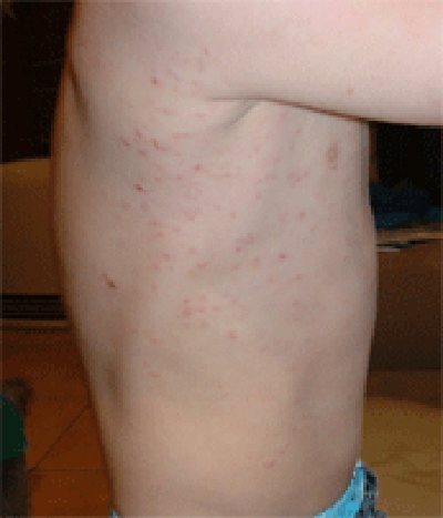 wg_12days After 12 days