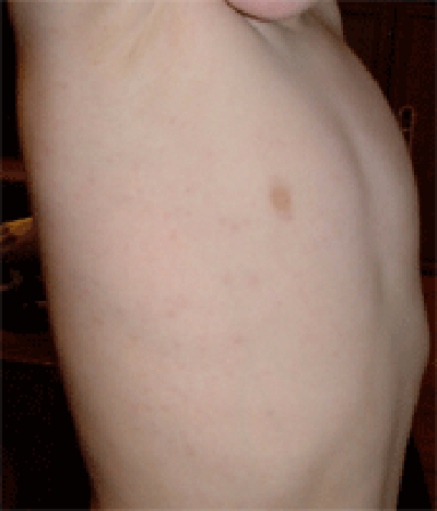 wg_25days1 After 25 days