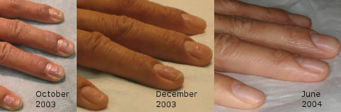 nails_combined nails_combined