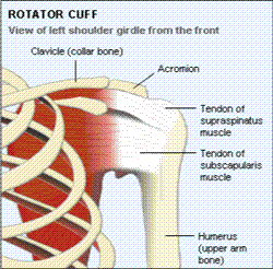 Rotator cuff or shoulder impingement syndrome